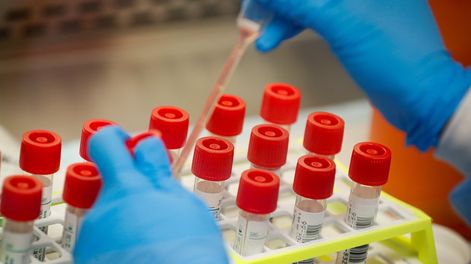 El virus que puede hacernos más humanos - Por Leonardo Oliva