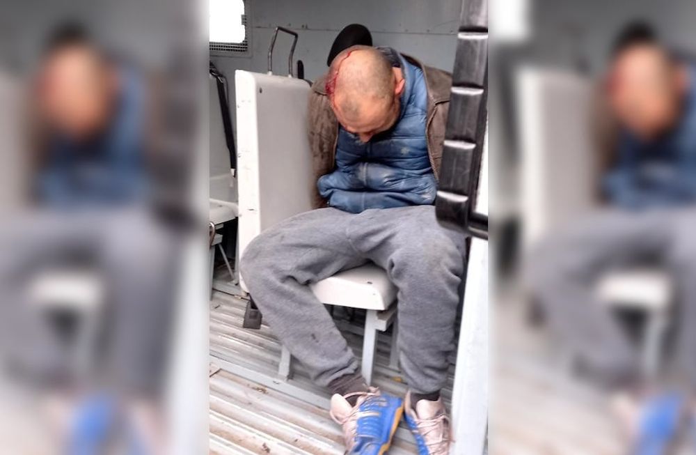 El ladrón debió ser atendido por un médico y derivado al hospital Central. / Gentileza Ministerio de Seguridad