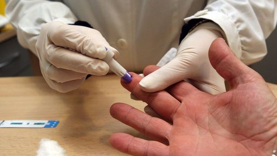 Preocupa la reducción de testeos de VIH en un 40%, producto de la cuarentena