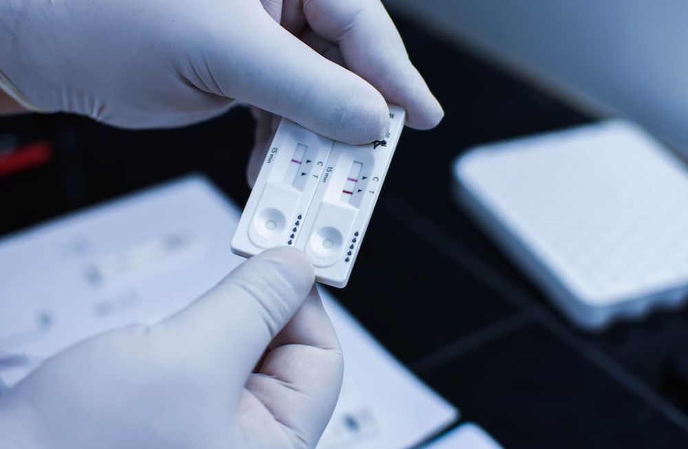 San Martin. Laboratorios particulares realizan los nuevos testeos por hisopado para detectar antígenos para Covid 19.Foto: Mariana Villa / Los Andes
