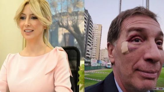 Santillí asistió a la cumbre del PRO con apositos y un ojo hinchado, hecho que llamó la atención de los presentes. Foto: Gentileza / @diegosantilliok - TikTok