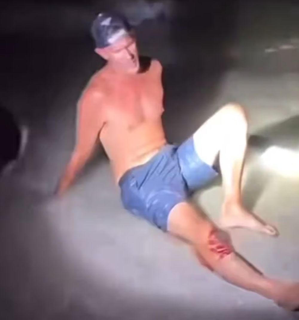 Shawn Meuse, un pescador que festejaba su cumpleaños, fue mordido en la pierna por un tiburón limón de 1,8 metros mientras intentaba tomarse una selfie con el animal capturado.