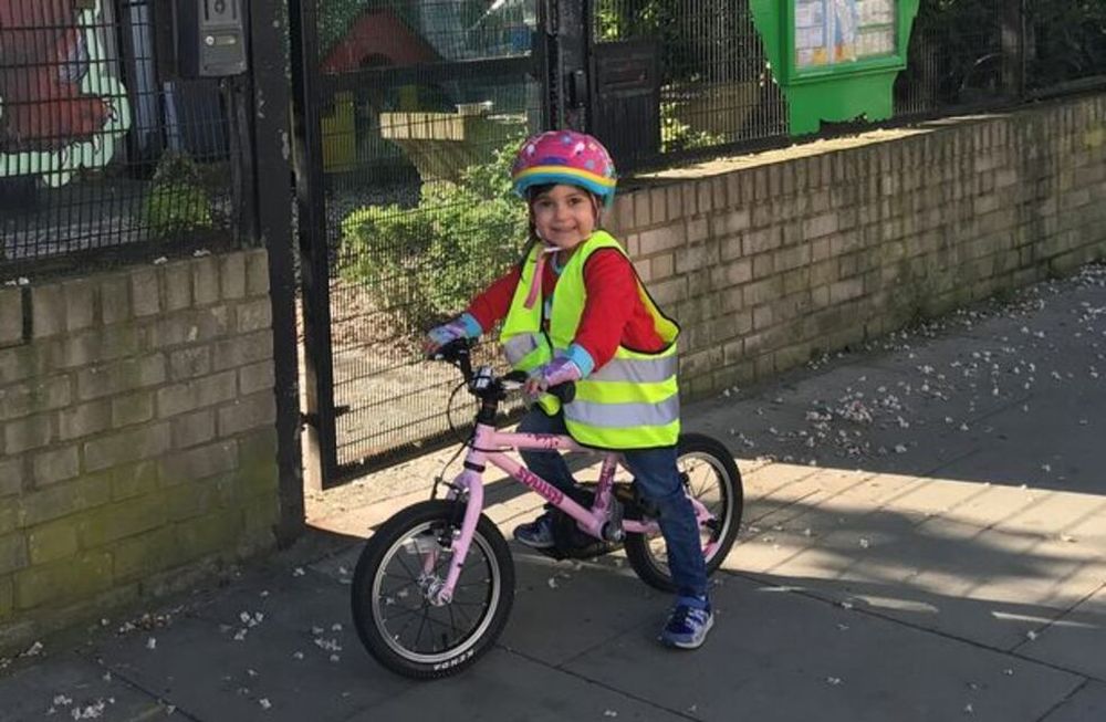 La nena de aspecto angelical y sana desde el exterior, tiene un trastorno genético llamado alcaptonuria, o enfermedad de los huesos negros.