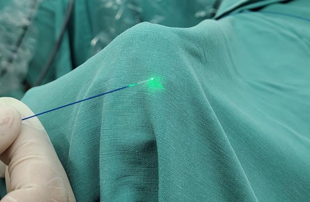 El Hospital Español de Mendoza incorporó una novedosa tecnología láser para la cirugía de próstata