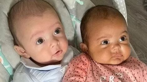 Una mamá se hizo viral por dar a luz a mellizos de distintos tonos de piel