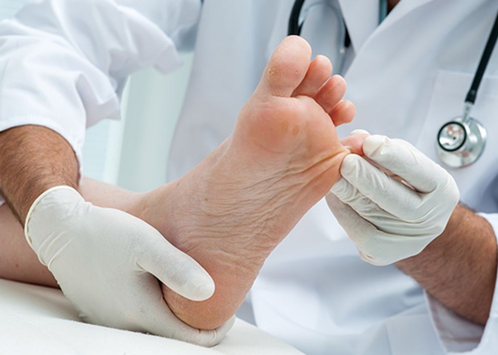 Cómo evitar los hongos en los pies: hábitos simples que marcan la diferencia, según la ciencia
