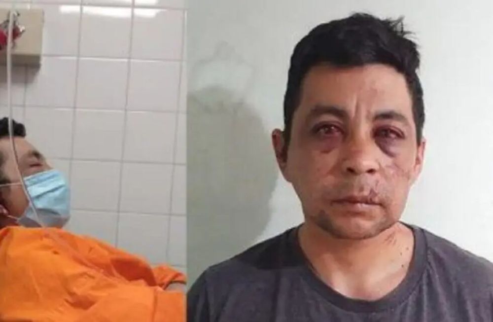 Murió Daniel Porro, el enfermero que había sido brutalmente golpeado por sus vecinos al haberse contagiado Covid-19. Archivo