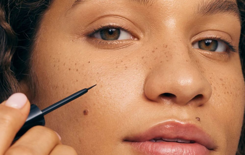 Las pecas son inofensivas pero anticipan un cuidado indispensable en el cuerpo.