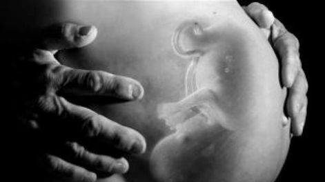 Todo aborto provocado es homicidio - Por Eduardo Cattaneo