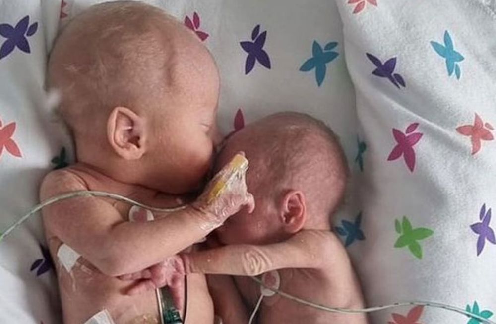 Dos bebés gemelos se abrazaron tras ser reunidos en la misma incubadora.