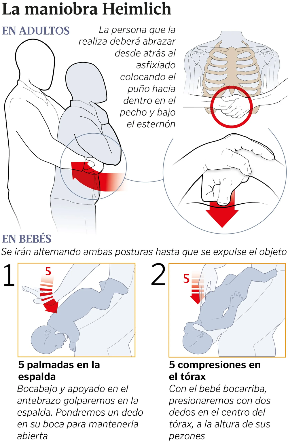 Paso a paso para realizar la maniobra de Heimilch en adultos