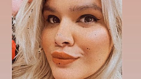 Morena Rial mostró una nueva imagen luego su paso por el quirófano