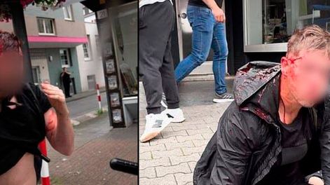 Los Andes | Graves disturbios, caos y heridos entre hinchas serbios y albaneses en Alemania por la Eurocopa. Foto: X / @Barras_LATAM