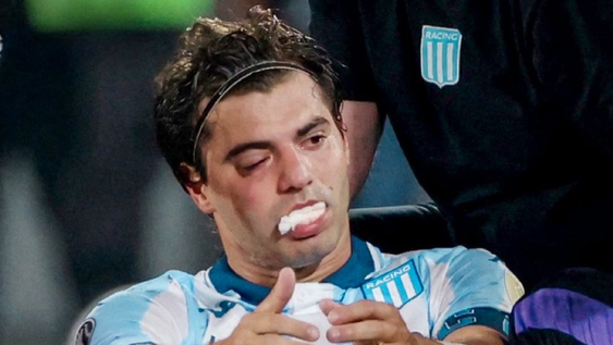 la lesion de santiago sosa que preocupa a todo racing