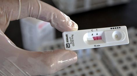 Los Andes | A nivel nacional, durante agosto se observó un incremento de 40% en las notificaciones. En Mendoza, las notificaciones semanales se triplicaron. | Foto: Orlando Pelichotti / Los Andes