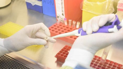 Los Andes | En 15 minutos el nuevo test detecta antígenos, proteínas que se expresan en las células ante la presencia del coronavirus. / Mariana Villa