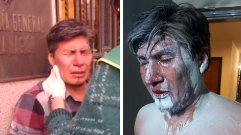 El diputado del FIT Alejandro Vilca denunció que fue gaseado durante la marcha de jubilados.