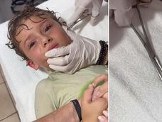Extrajeron un cangrejo diminuto del oído de una conocida influencer mexicana. Tanto el niño como el animal están a salvo.&nbsp;