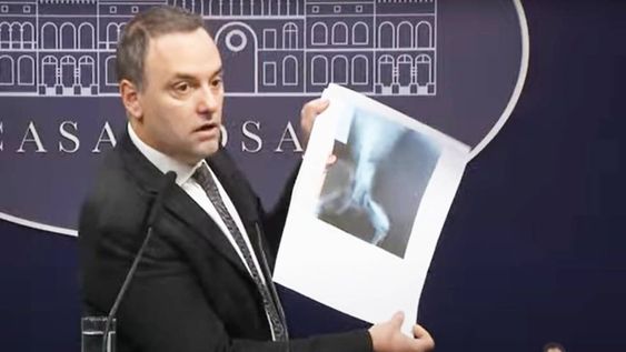 El vocero del gobierno nacional, Manuel Adorni mostró la radiografía de un perro que dijo que fue usada para obtener una pensión por invalidez.