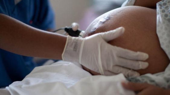 Comienza la vacunación contra Covid-19 para embarazadas de riesgo y con alta exposición al virus