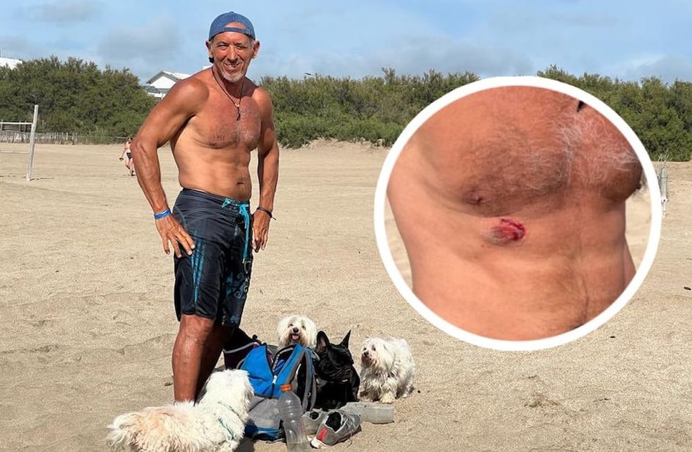 Un vendedor ambulante lo mordió tras una pelea en Pinamar y lo denunció, pero cuando supo que el hombre podría quedarse sin trabajo intervino para ayudarlo. Foto: Twitter