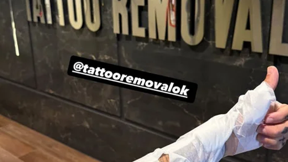 Alex Caniggia comenzó un tratamiento para quitarse los tatuajes.
