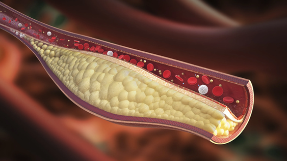 3 alimentos que limpian las arterias y regulan la presión arterial
