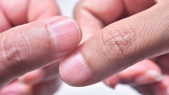 que significa tener las unas con rayas, segun la ciencia
