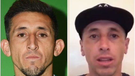 El mexicano Héctor Herrera se hizo una cirugía estética y estallaron los memes