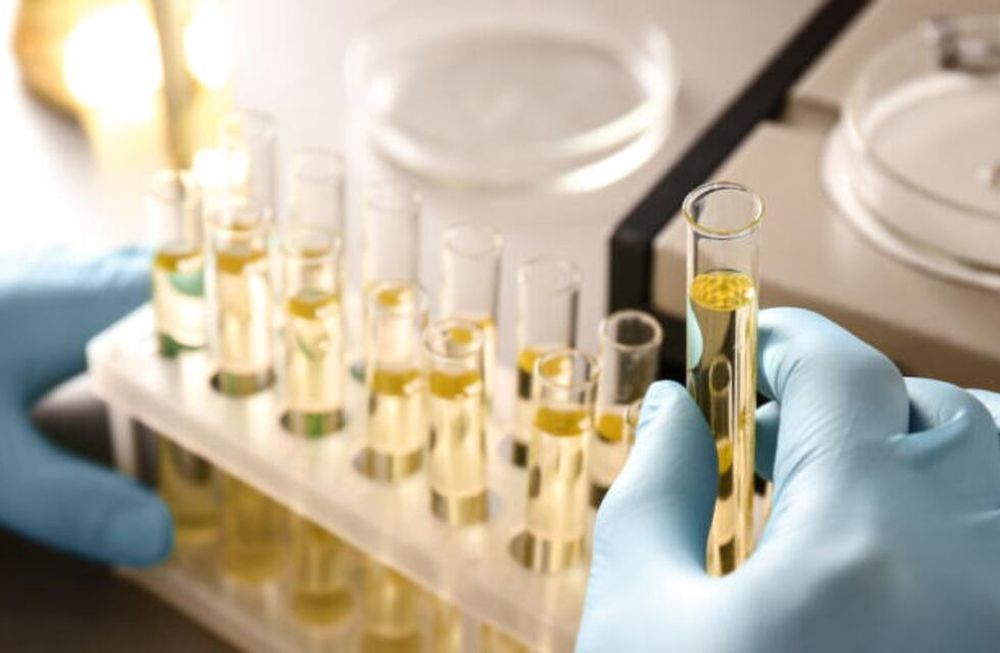 Registraron el primer caso en la historia de una mujer que orina alcohol.