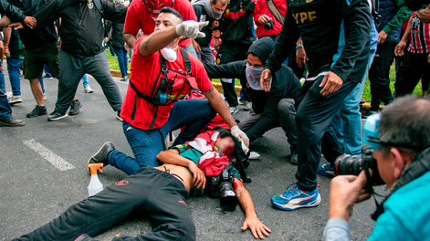 Un reportero gráfico fue herido de gravedad durante la represión policial.
