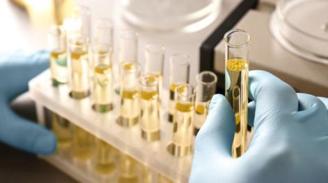 Registraron el primer caso en la historia de una mujer que orina alcohol.
