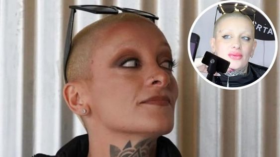 Furia Scaglione compartió en sus redes sociales el antes y después de su micropigmentación labial, mostrando con orgullo el resultado final.