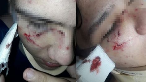 Santiago sufrió múltiples herida y debió ser llevado de urgencia al Hospital. Foto: Gentileza