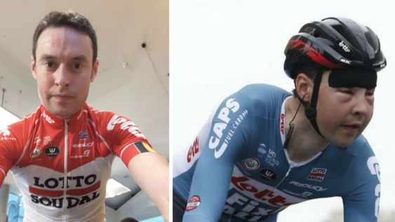 Una avispa le desfiguró la cara y su equipo no lo medicó por miedo al doping positivo