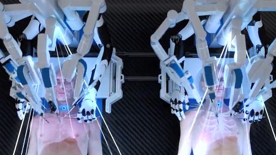 Captura de video - BrainBridge