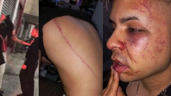 Video: patovicas de un boliche de Tucumán atacaron a latigazos a una pareja y les provocaron graves heridas. / Foto: captura de video / Los Andes