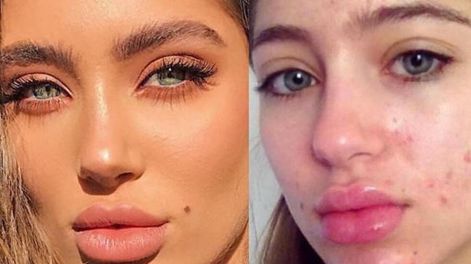 Una nueva ley prohíbe que los influencers y modelos utilicen filtros para borrar imperfecciones ya que transmite un mensaje erróneo de la realidad.