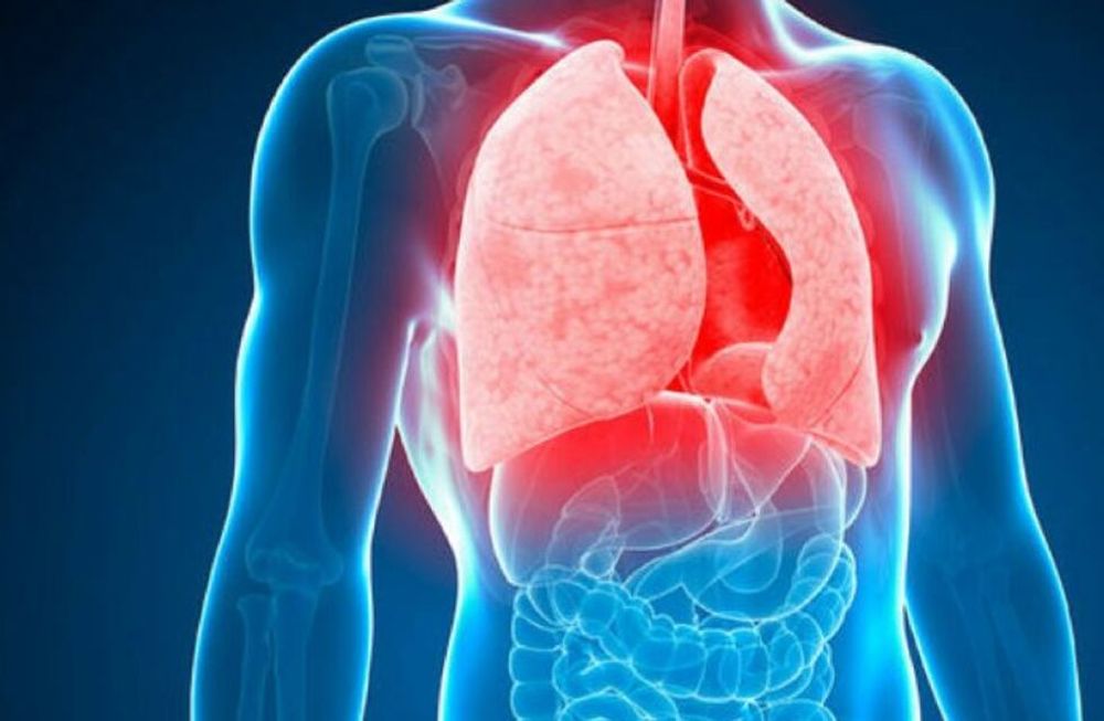 La OMS pide acciones urgentes para acabar con la tuberculosis