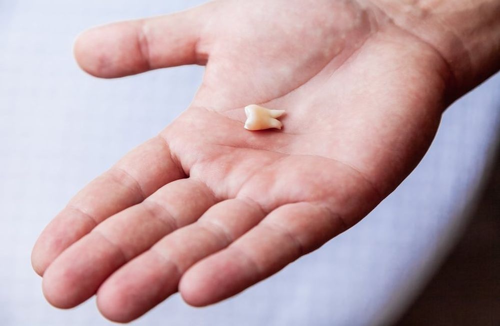 Traumatismos dentales: ¿qué hacer y cómo prevenirlos?