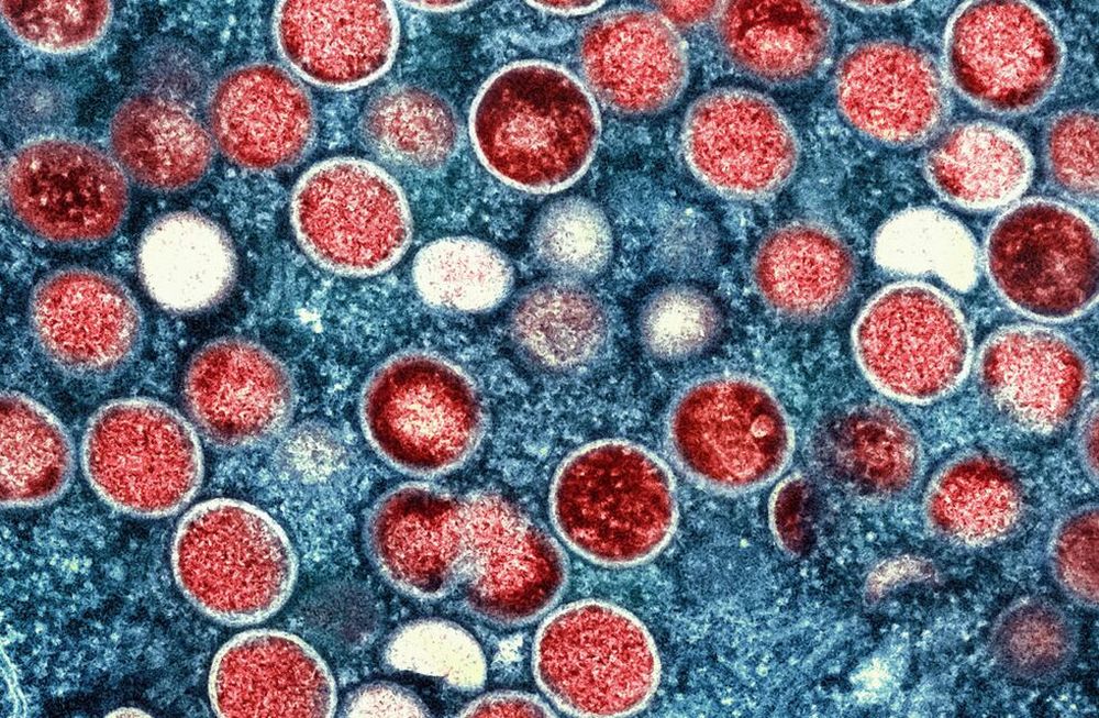 Virus. Se secuenciaron varias muestras de viruela del mono para determinar el origen del brote. (Instituto de Enfermedades Infecciosas y Alergias de EE.UU.)