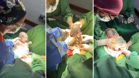 Nacieron trigemelas en Salta.