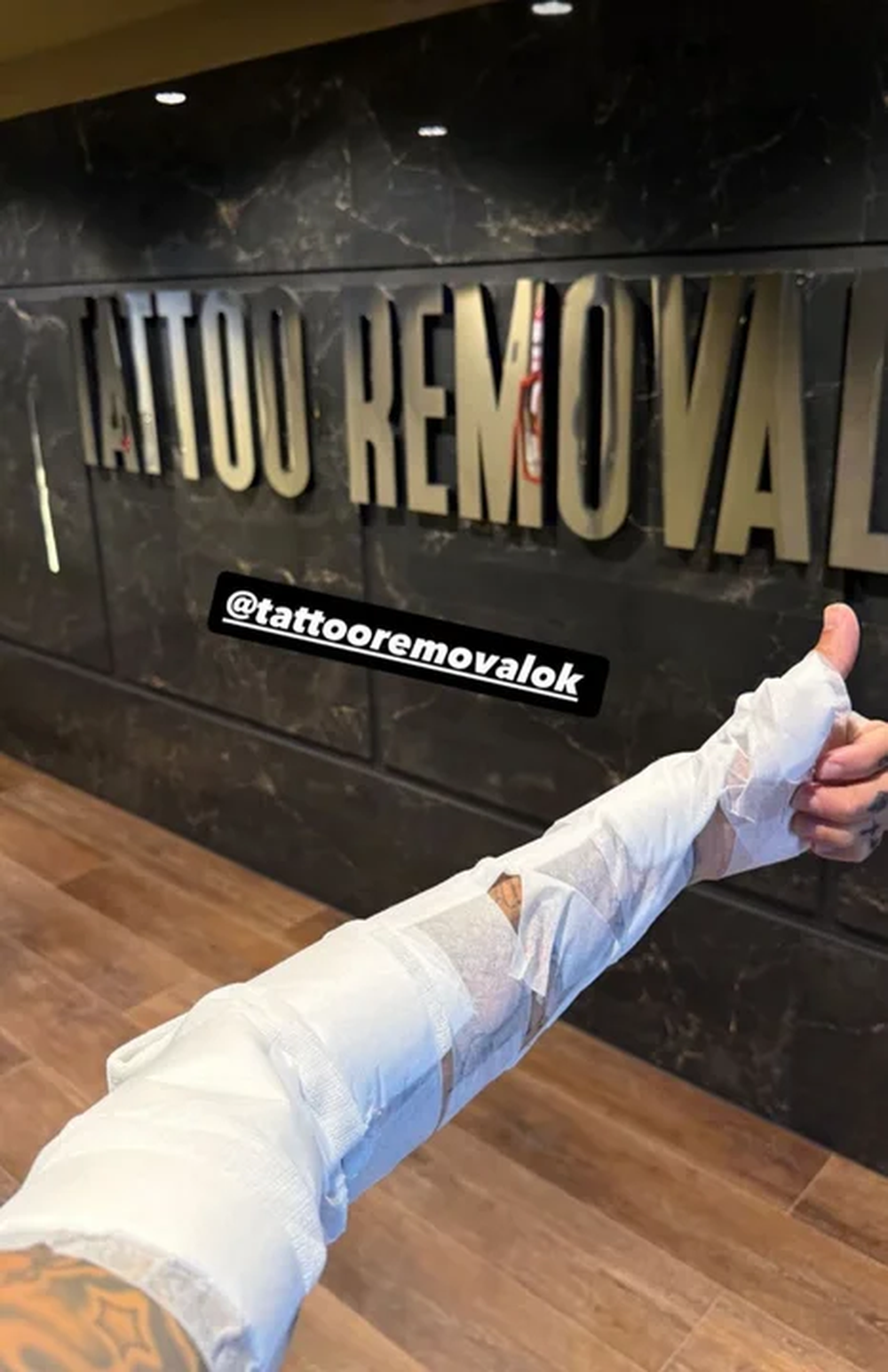Alex Caniggia comenzó un tratamiento para quitarse los tatuajes.