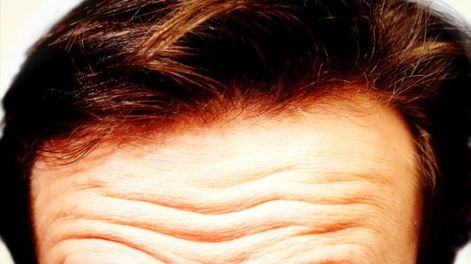 Frentes arrugados - Por Jorge Sosa