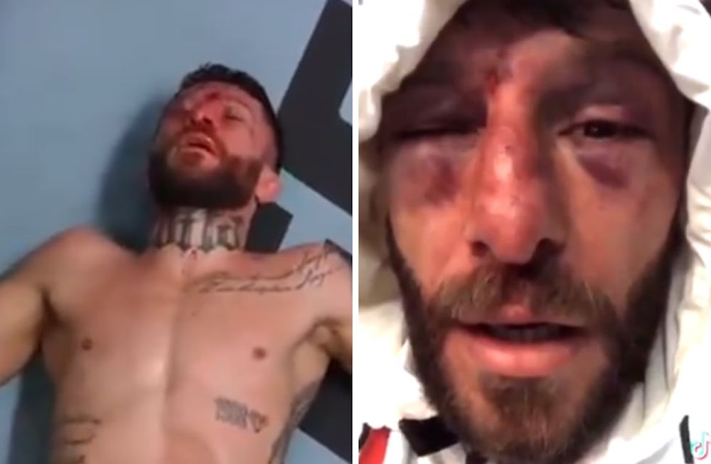 Así quedó el rostro del luchador argentino tras el combate contra el canadiense.