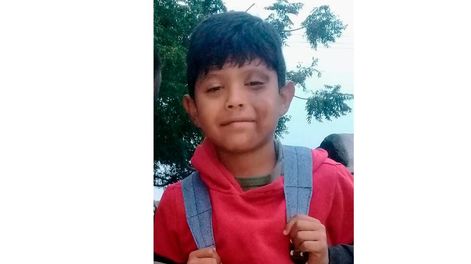 Daniel se quemó la cara y necesita viajar