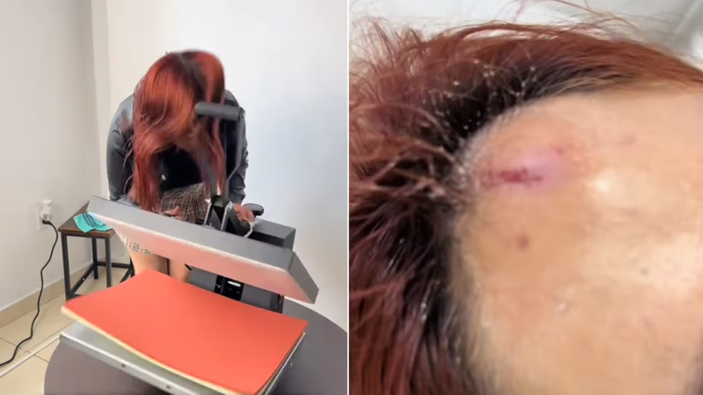 Una emprendedora quiso mostrar su última adquisición en las redes y terminó en el hospital.