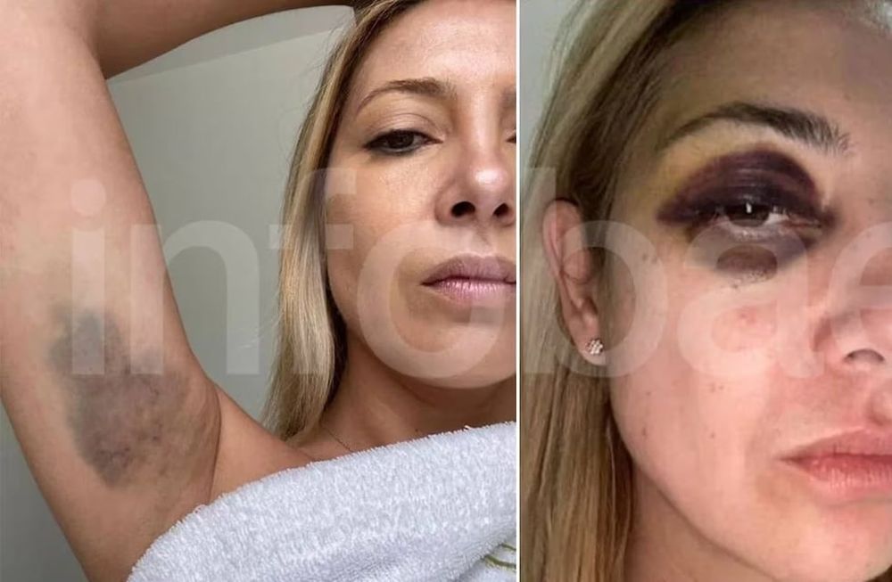 Se conocieron las fotos de Fabiola Yañez en medio de la denuncia por violencia de género contra el expresidente Alberto Fernández.