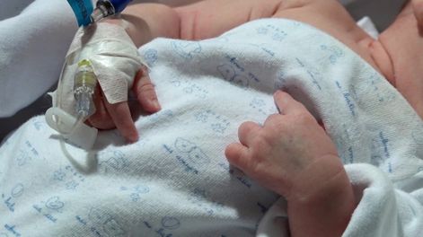 Un juez autorizó una cirugía urgente para un bebé, pese a que sus padres no querían por razones religiosas.