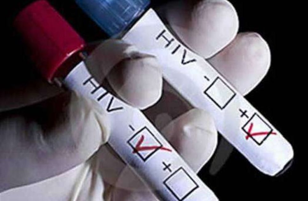 Instan a realizarse test para detectar VIH